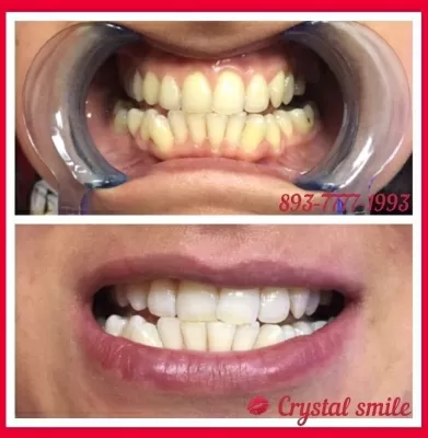 Crystal Smile