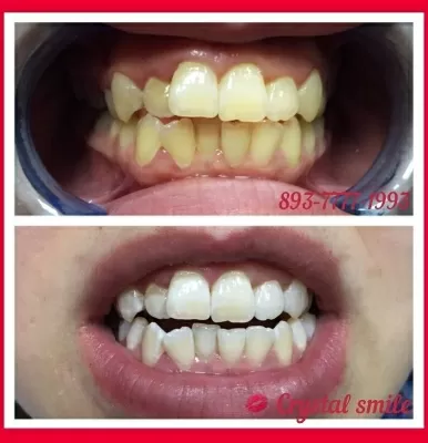 Crystal Smile