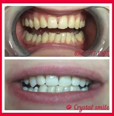 Crystal Smile