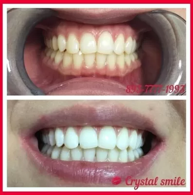 Crystal Smile