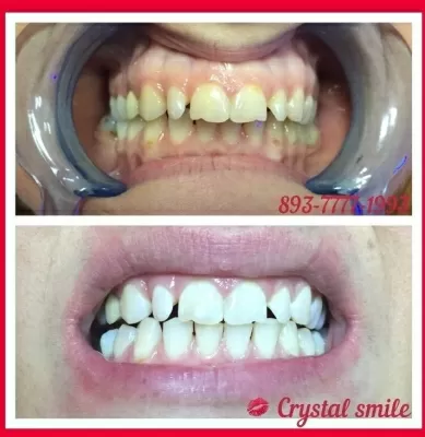 Crystal Smile