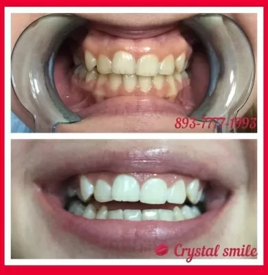 Crystal Smile