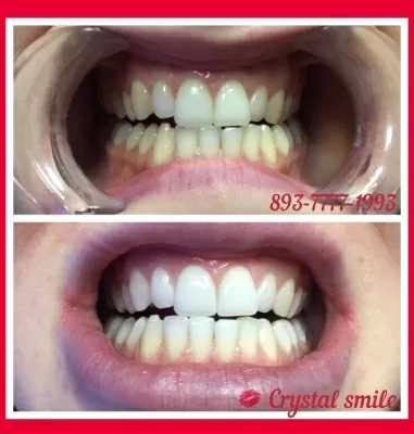 Crystal Smile
