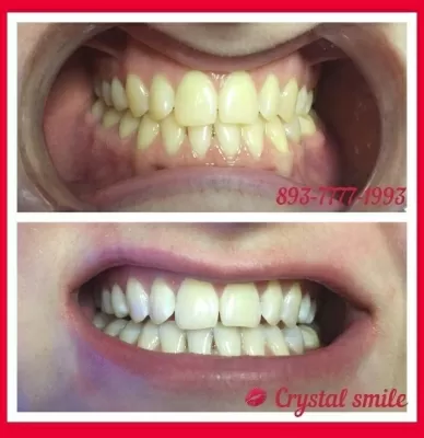 Crystal Smile