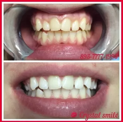 Crystal Smile
