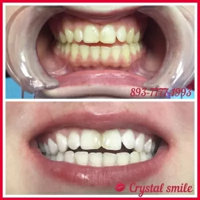 Crystal Smile