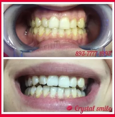 Crystal Smile