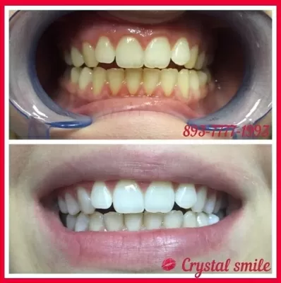 Crystal Smile