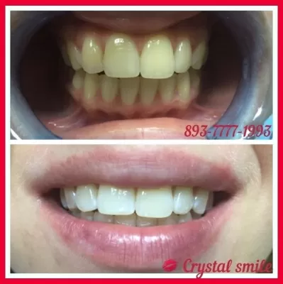 Crystal Smile