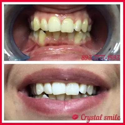 Crystal Smile