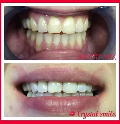 Crystal Smile
