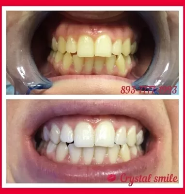 Crystal Smile