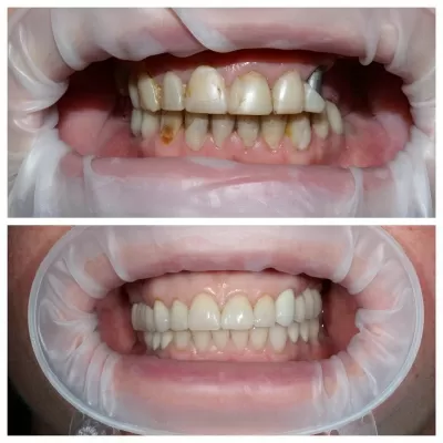 Центр имплантологии доктора Ермакова