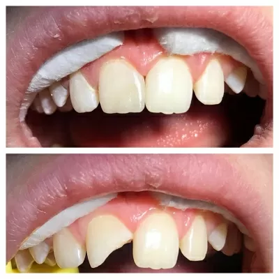 Центр имплантологии доктора Ермакова