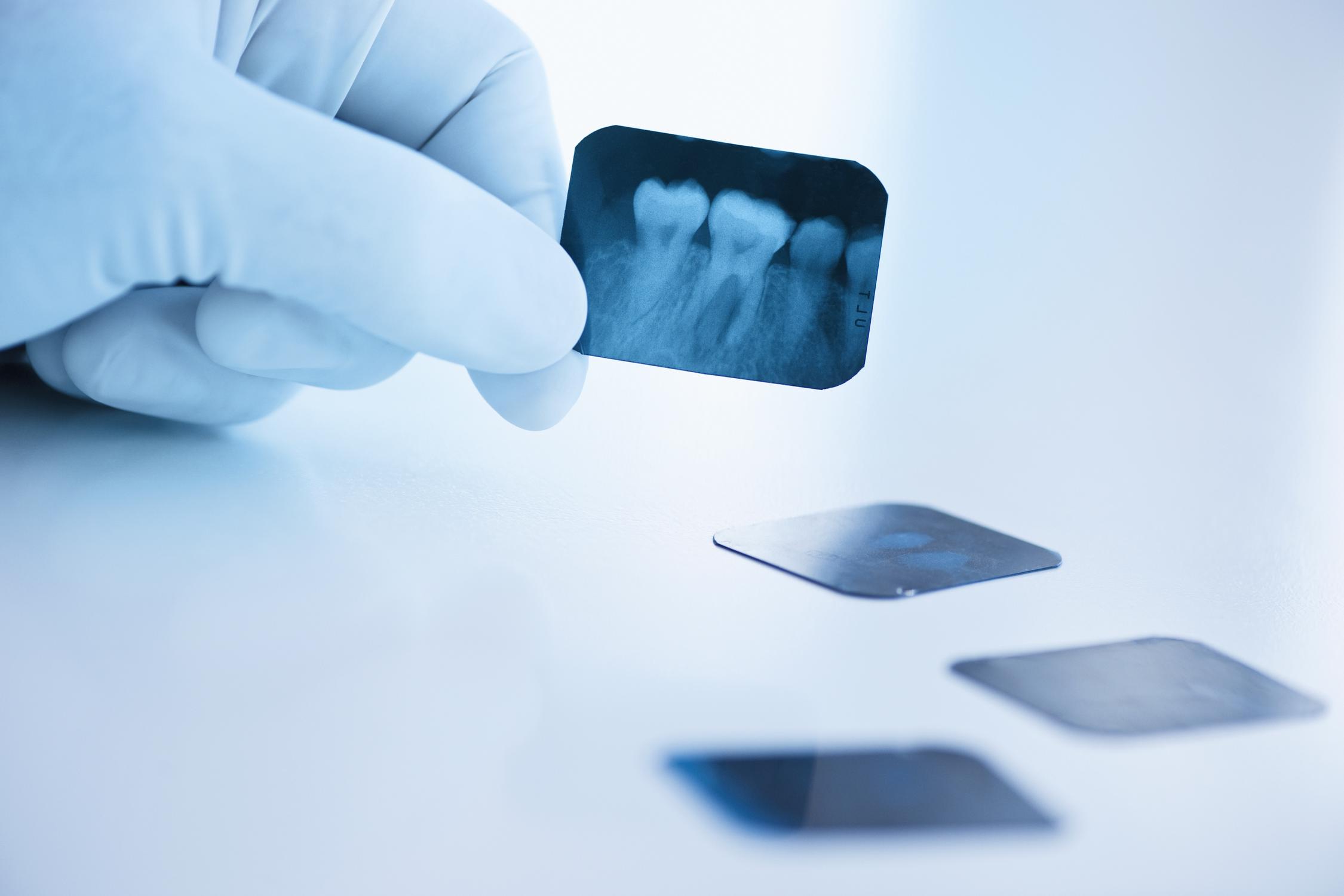 Рентген прицельный для стоматологии