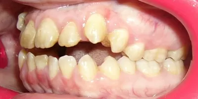 Птичка Тари