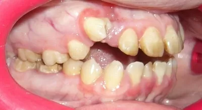 Птичка Тари