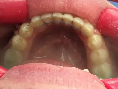 Птичка Тари