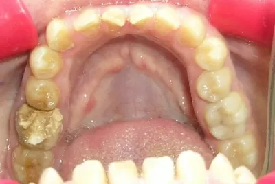 Птичка Тари