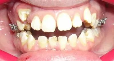 Птичка Тари