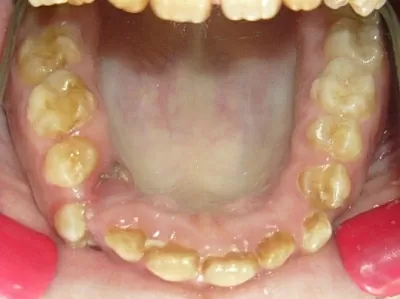 Птичка Тари