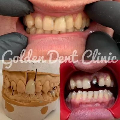Golden Dent Clinic