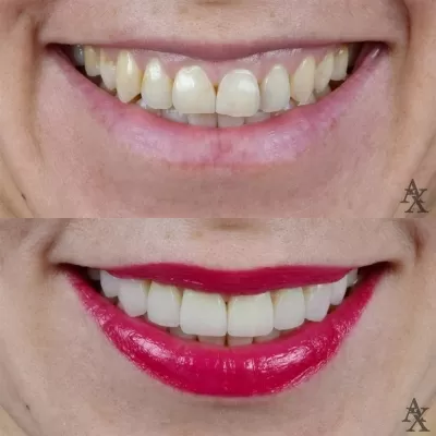 Денталь Профи