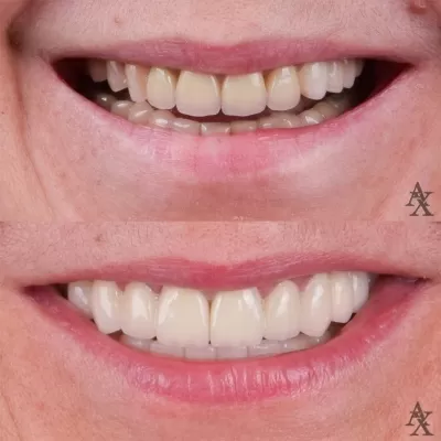 Денталь Профи