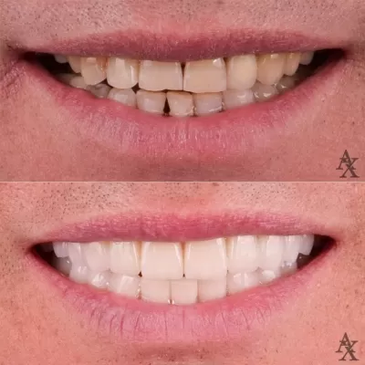 Денталь Профи