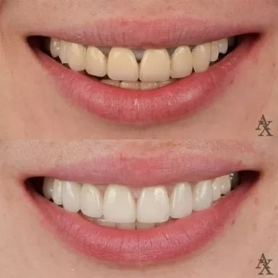 Денталь Профи