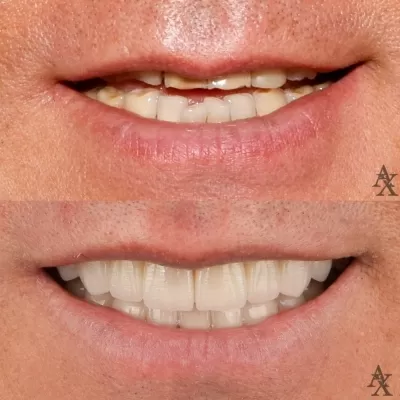 Денталь Профи