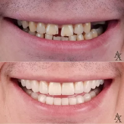 Денталь Профи