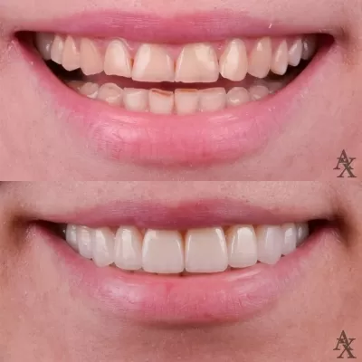 Денталь Профи