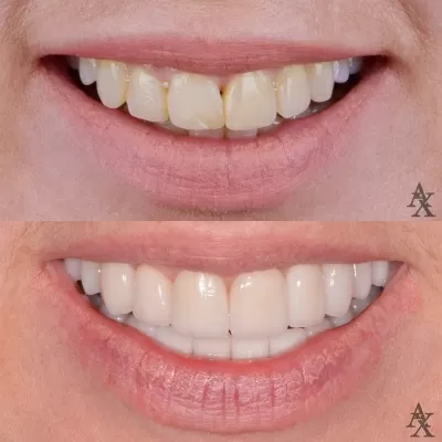 Денталь Профи