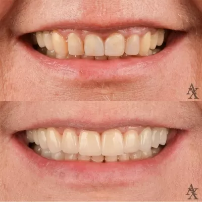 Денталь Профи