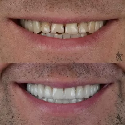 Денталь Профи