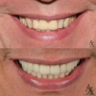 Денталь Профи