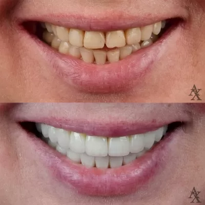 Денталь Профи