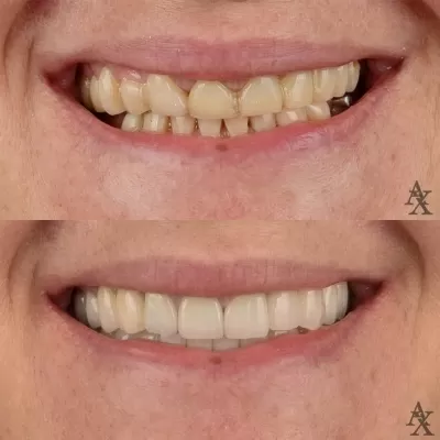 Денталь Профи