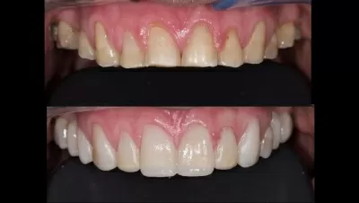 Филигранно