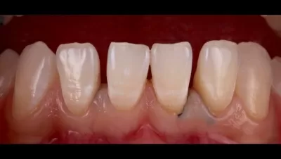 Филигранно