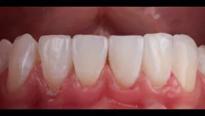 Филигранно