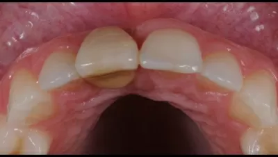 Филигранно