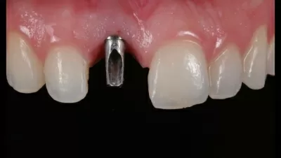 Филигранно