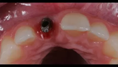 Филигранно