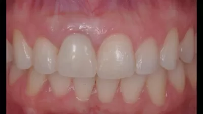 Филигранно