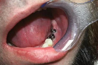 Филигранно