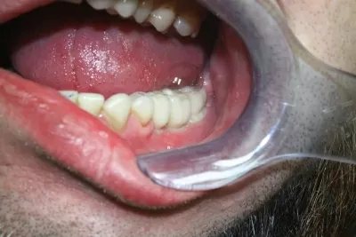 Филигранно