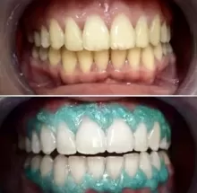 Гасанов Гамид Гасанович