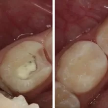 Бештоева Арина Мусарбиевна